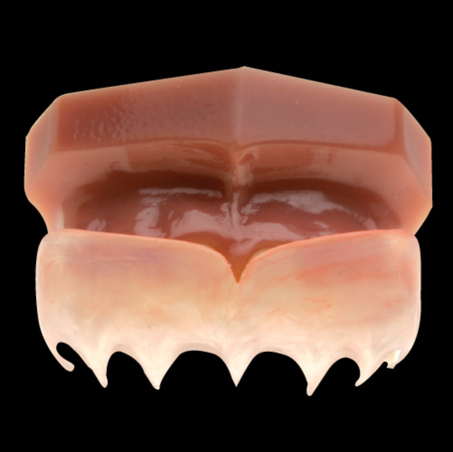 A removable pink gingival mask made by Allure Dental Laboratory